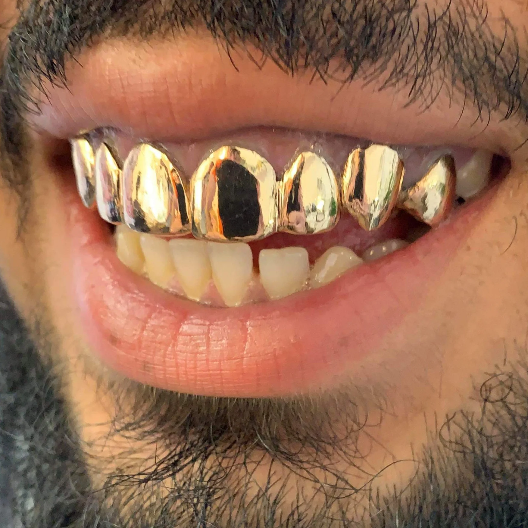 Eight Set of Grillz - Image 4