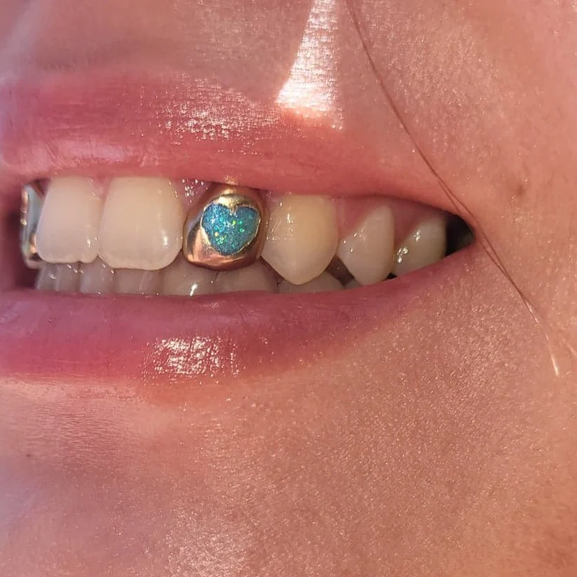 Enamel Heart (Opal effect) single cap *Any colour* - Image 3