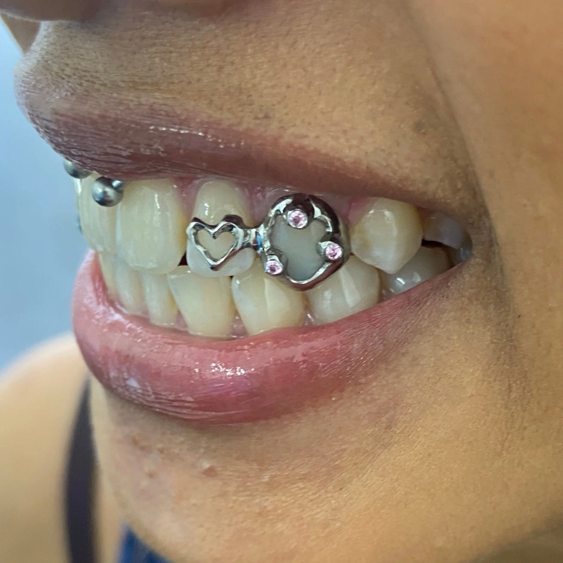 Single Grillz