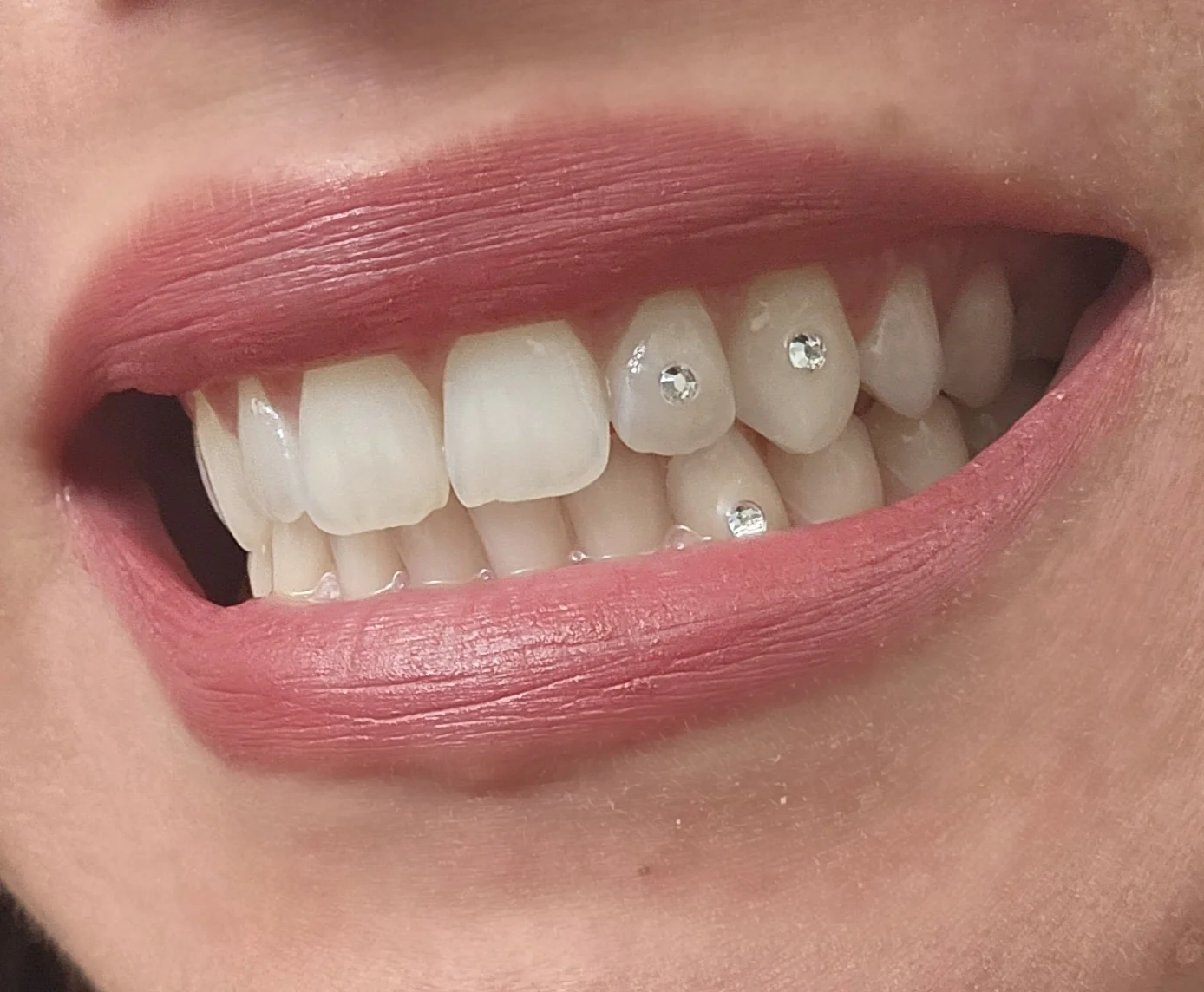 DIY Tooth Gem Kit - Image 3